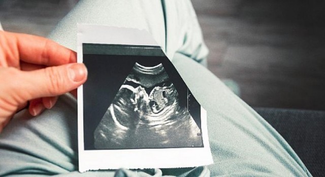 Genetik hastalık anne karnında bir kan testiyle belirleniyor