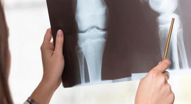 Hareketsizlik Kemiklerimizi Güçsüzleştiriyor