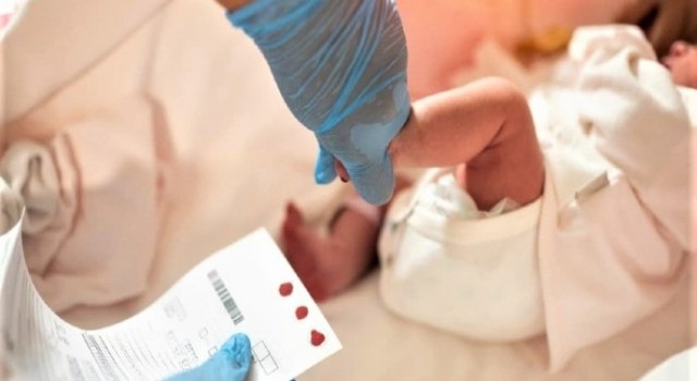 KKTC’de ilk kez SMA taşıyıcılık testi yapılmaya başlandı