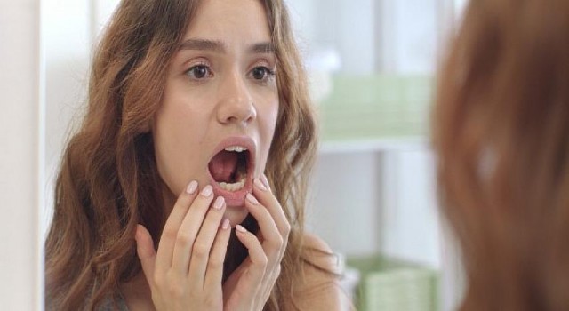 Ağız Yaralarında 7 Önemli Neden!