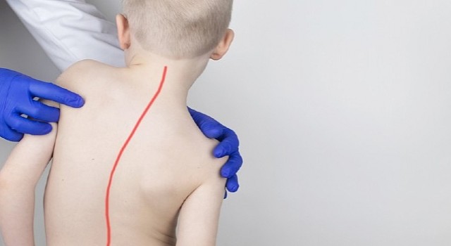 Skolyoz Tedavisinde Doğru Sanılan 7 Yanlışa Dikkat!