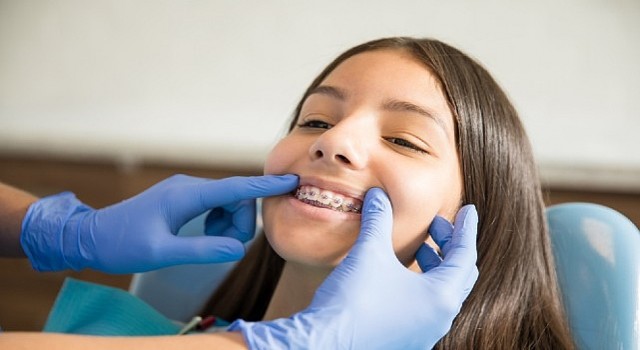 Ortodontik Tedaviler İçin Ergenlik En İdeal Dönem