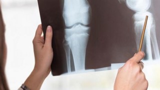 Hareketsizlik Kemiklerimizi Güçsüzleştiriyor