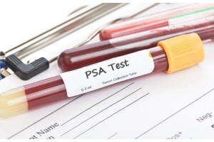 45 Yaşından Sonra Yılda 1 Kez Prostat Kanseri Taraması Yaptırılmalı