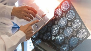 Bulanık Görme ve Güçsüzlük MS Belirtisi Olabilir