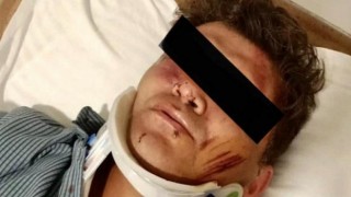 Sağlıkta şiddette geldiğimiz yer, sopalarla sokakta doktor dövmek