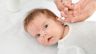 Yenidoğan Dönemindeki İşitme Kaybı Konjenital CMV Enfeksiyonuna İşaret edebilir!