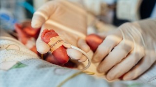 Türkiyede Doğan Bebeklerin %12si Prematüre!