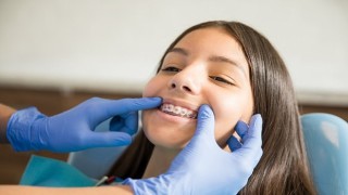 Ortodontik Tedaviler İçin Ergenlik En İdeal Dönem