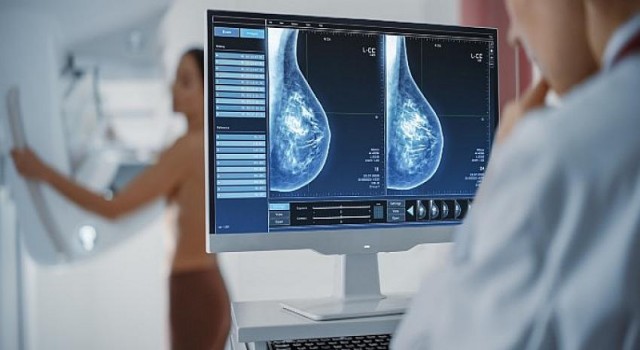 Mamografi Taramasını Atlamak Hayati Risk Oluşturabiliyor!