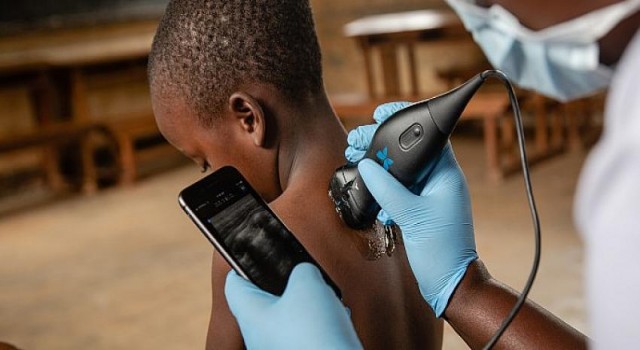 Butterfly iQ+ teknolojisi, tıbbi görüntülemeyi dünyadaki herkes için erişilebilir hale getirecek