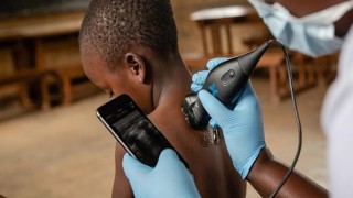 Butterfly iQ+ teknolojisi, tıbbi görüntülemeyi dünyadaki herkes için erişilebilir hale getirecek