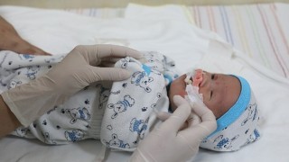 DEÜ Hastanesi Dudak-Damak Yarığı Tedavisinde Umut Oldu